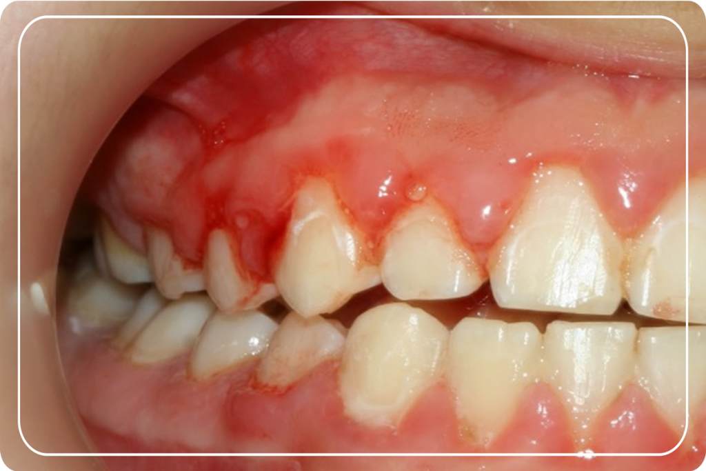 Diş Eti Hastalıkları ve Tedavisi Diş Estetiği Gülüş Tasarımı Dr