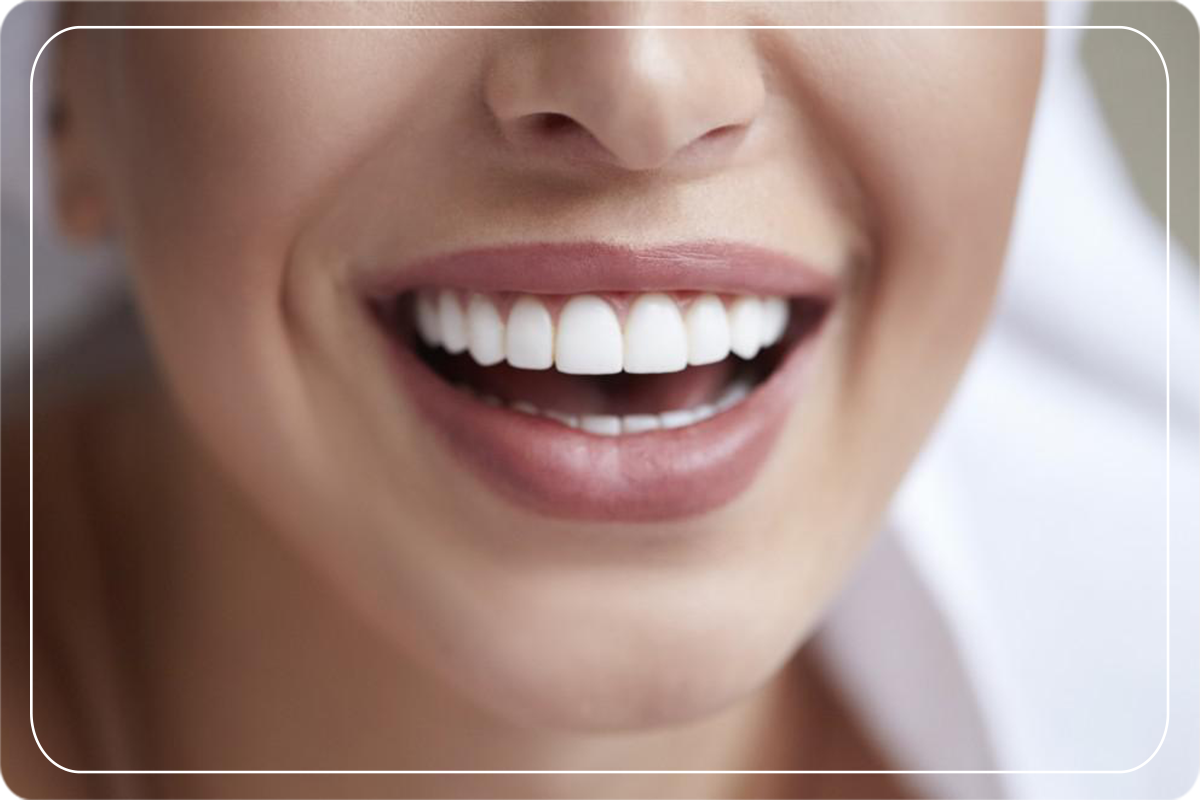 Gülüş Tasarımı Nasıl Olmalı Diş Estetiği Gülüş Tasarımı Dr. Dt