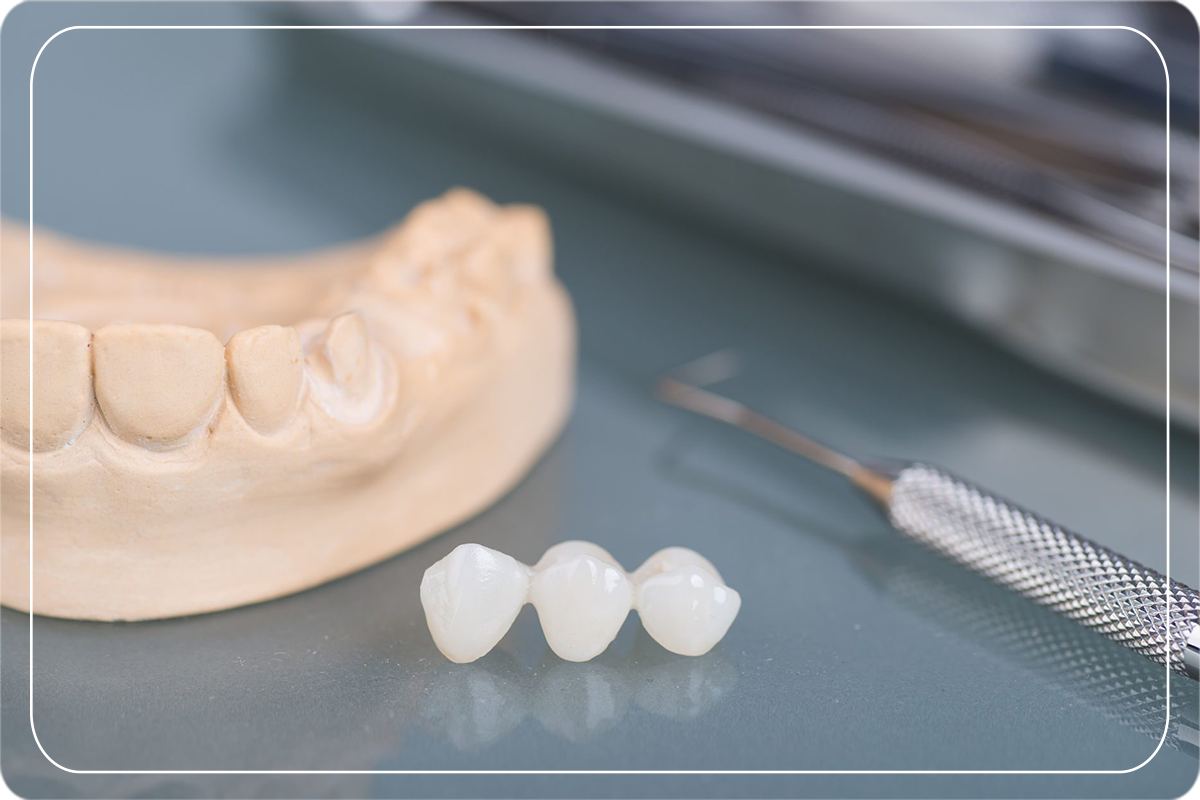 Zirkonyum Nedir Diş Estetiği Gülüş Tasarımı Dr. Dt. Ömer Bayar