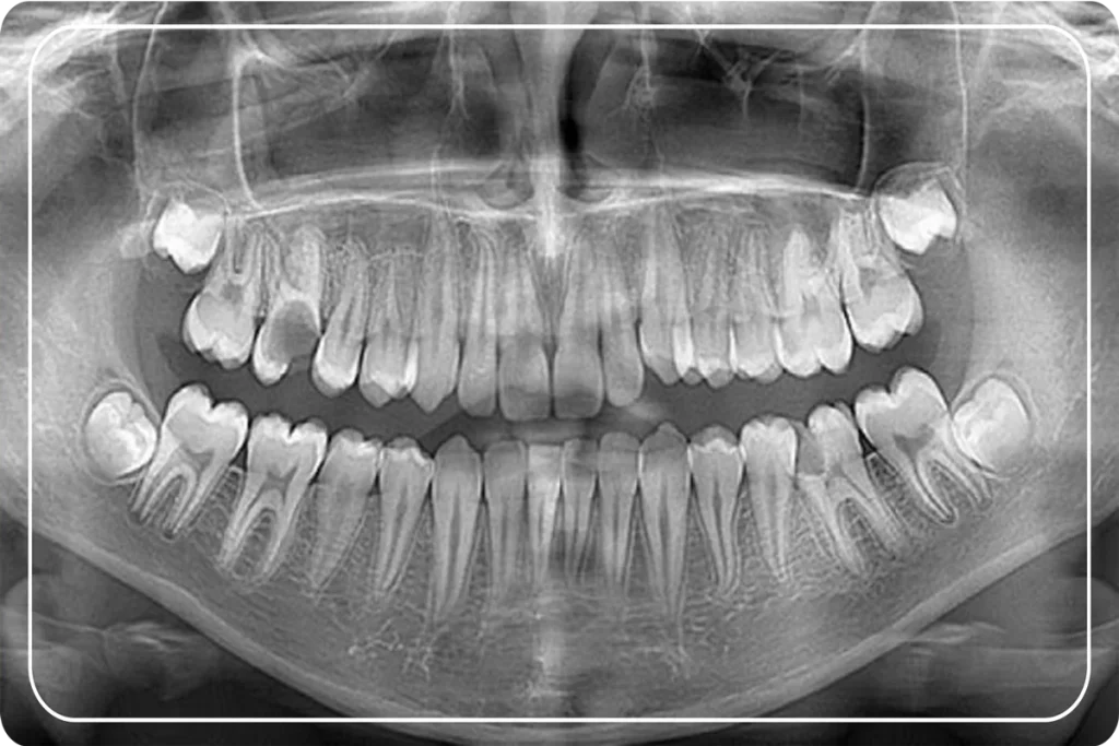 oral-diagnoz-ve-radyoloji